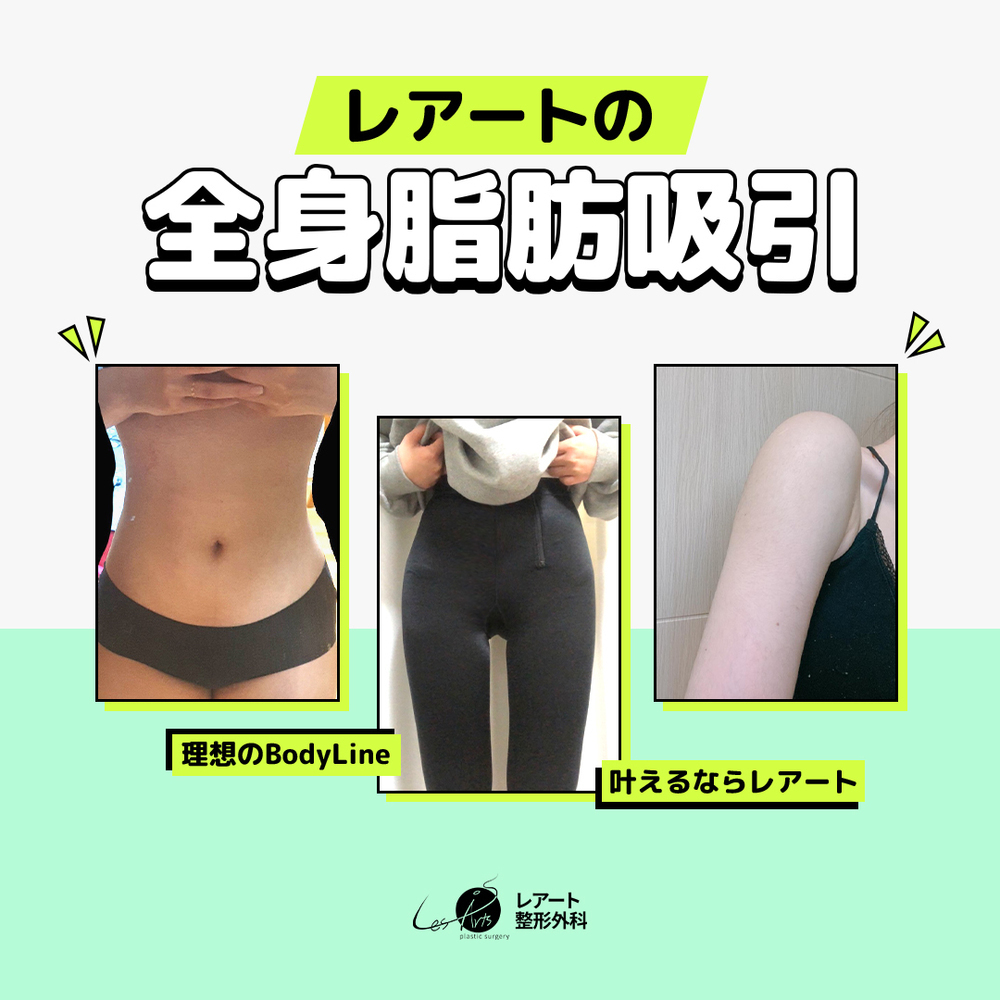 レアート整形外科 韓国で脂肪吸引するならレアート💓💁‍♀️