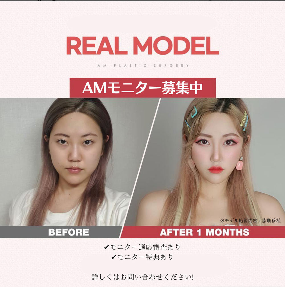 AM整形外科 AMモニター募集