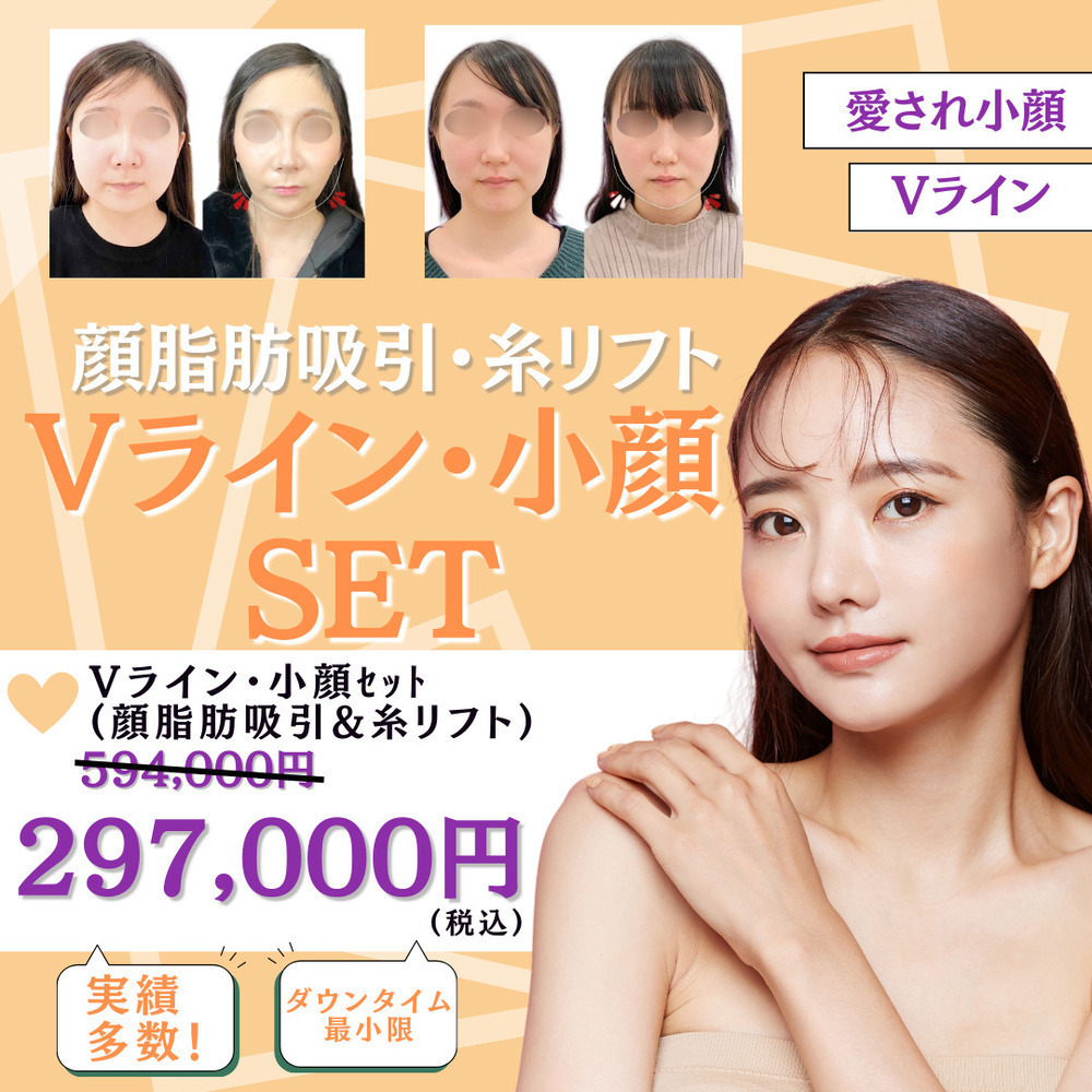 藤・ナチュレ美容クリニック 銀座院 ご存じですか？ナチュレで人気No.1施術「Vライン・小顔セット」