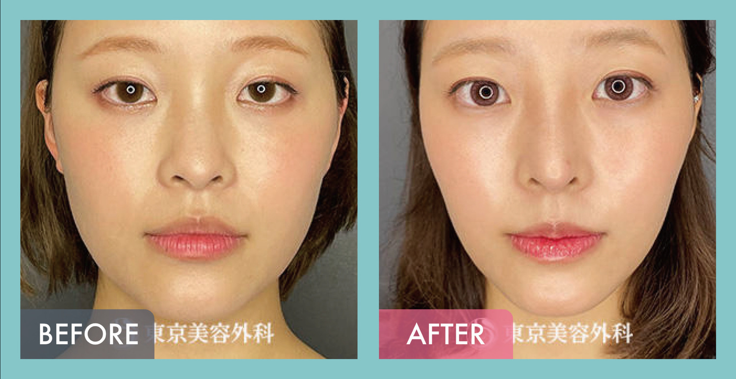 https://p1-1f54eb9e.imageflux.jp/uploads/image/file/4152/28d7bae7-ff18-43cc-8684-af9914831ebc.jpg