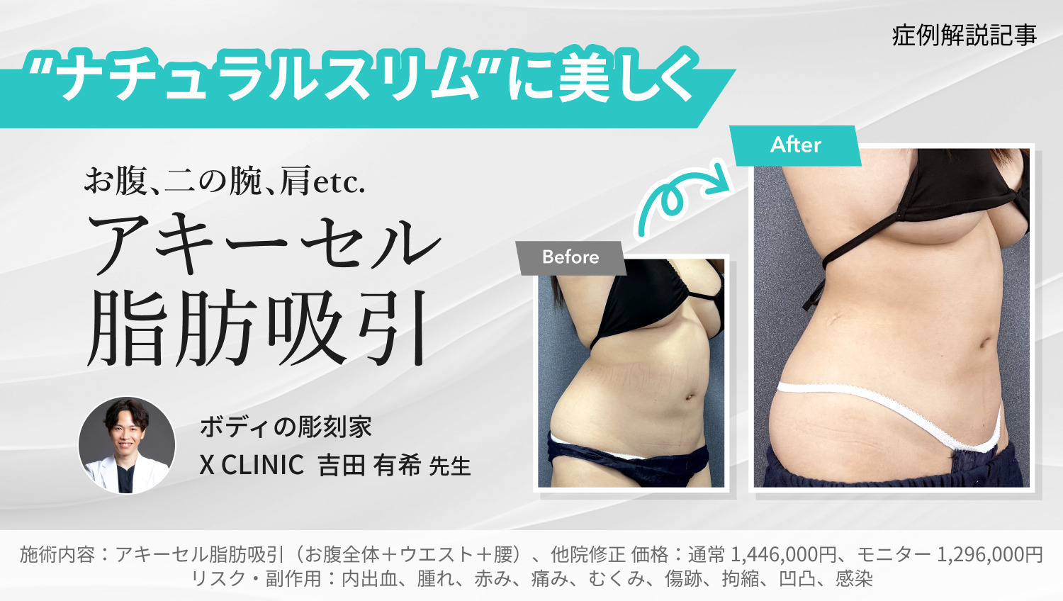 X CLINIC吉田先生｜滑らかボディに♡形成外科専門医の脂肪吸引