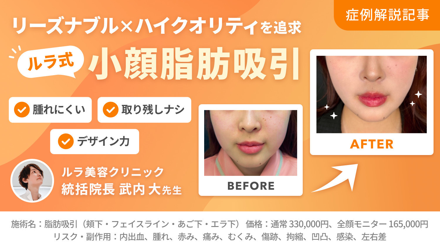 症例解説 武内先生｜ダウンタイム軽減×吸引技術に注目！小顔脂肪吸引