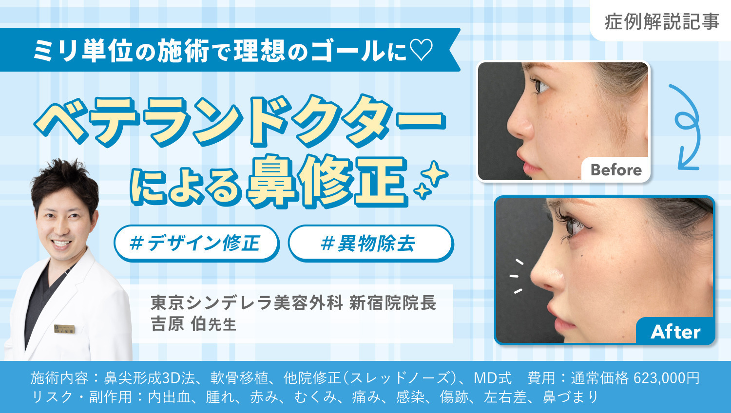 症例解説｜繊細な技術×柔軟な対応力！経験豊富な吉原先生の鼻修正