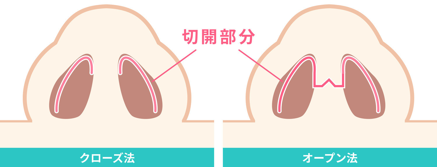https://p1-1f54eb9e.imageflux.jp/uploads/image/file/6058/48a3cabb-7714-48ed-9ac7-3fa9a37d0f49.jpg