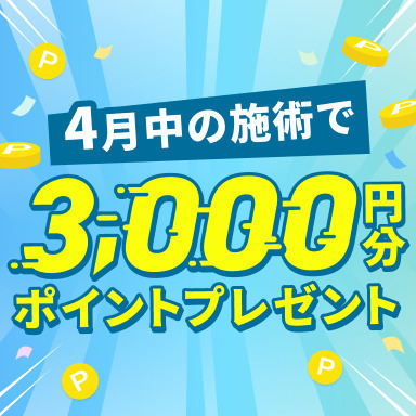 3,000ポイントが当たる！お得なスピード抽選キャンペーン開催中✨