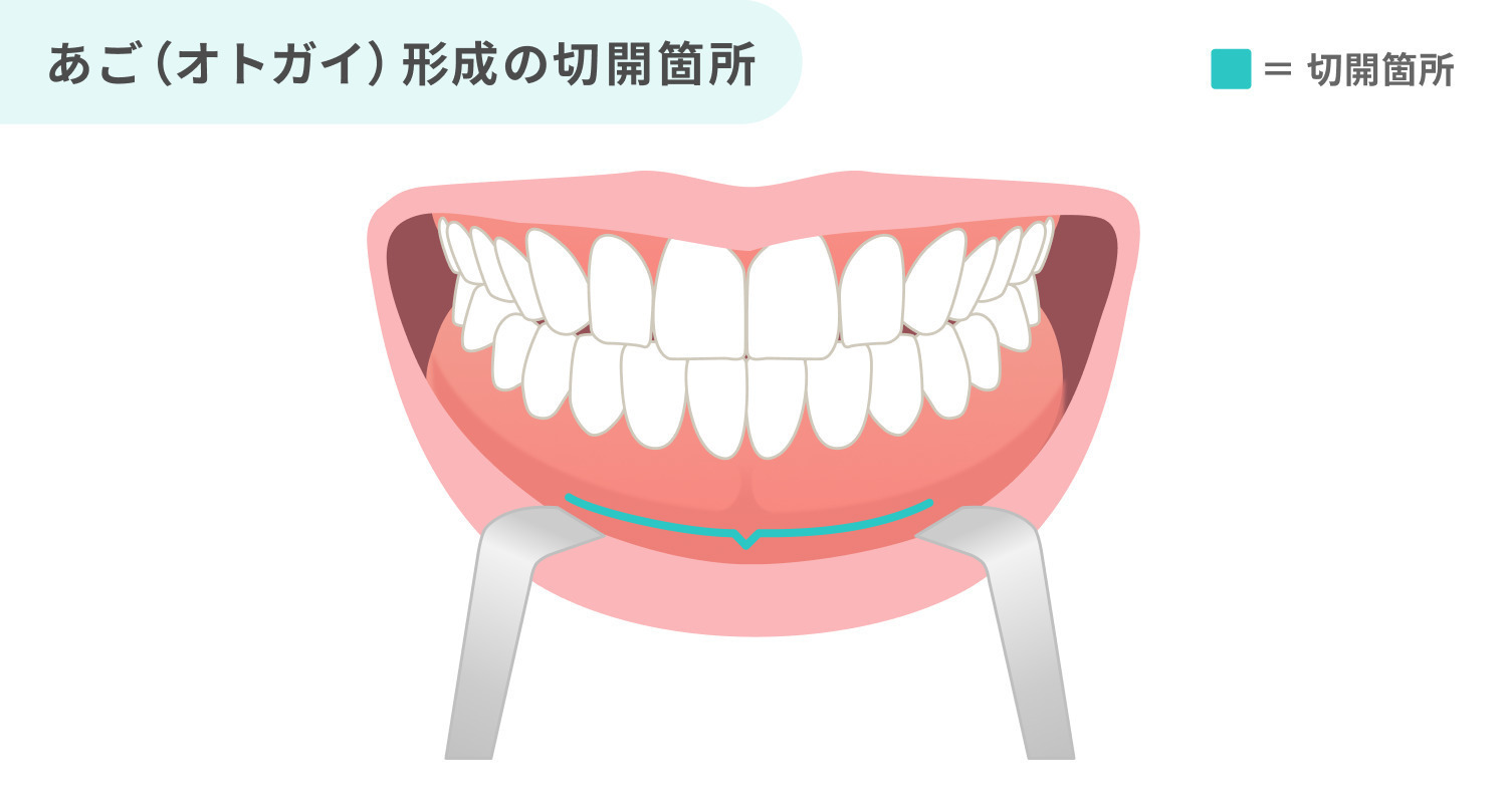 https://p1-1f54eb9e.imageflux.jp/uploads/image/file/6891/4091cbe6-15d3-40b2-9c6a-2423f5b9ba4b.jpg