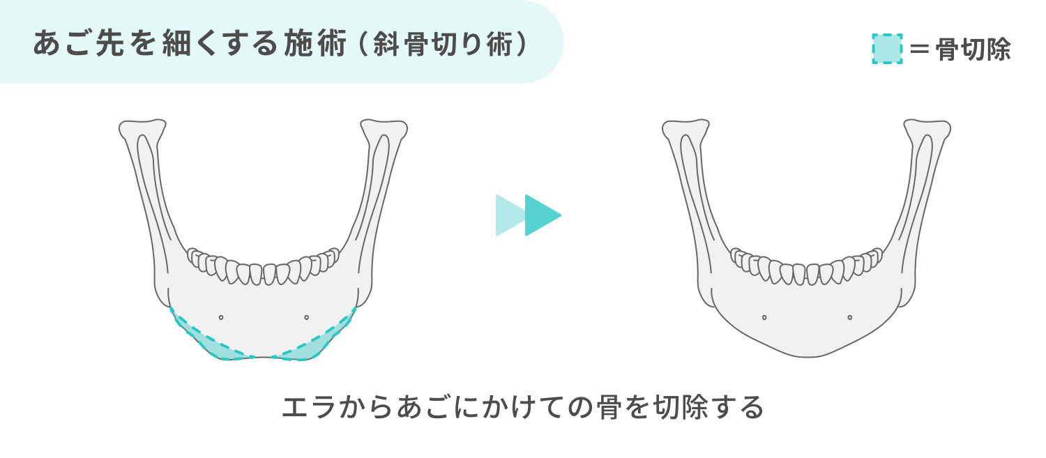https://p1-1f54eb9e.imageflux.jp/uploads/image/file/6893/a60f376b-8241-46de-8bf9-fdd3fd472d6d.jpg