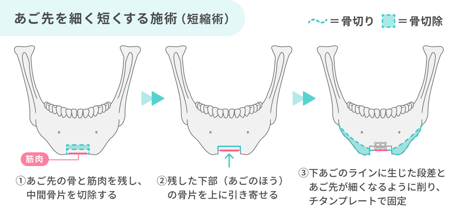 https://p1-1f54eb9e.imageflux.jp/uploads/image/file/6895/34c0a5fc-a58d-4a51-b6e4-e1e1020202e6.jpg