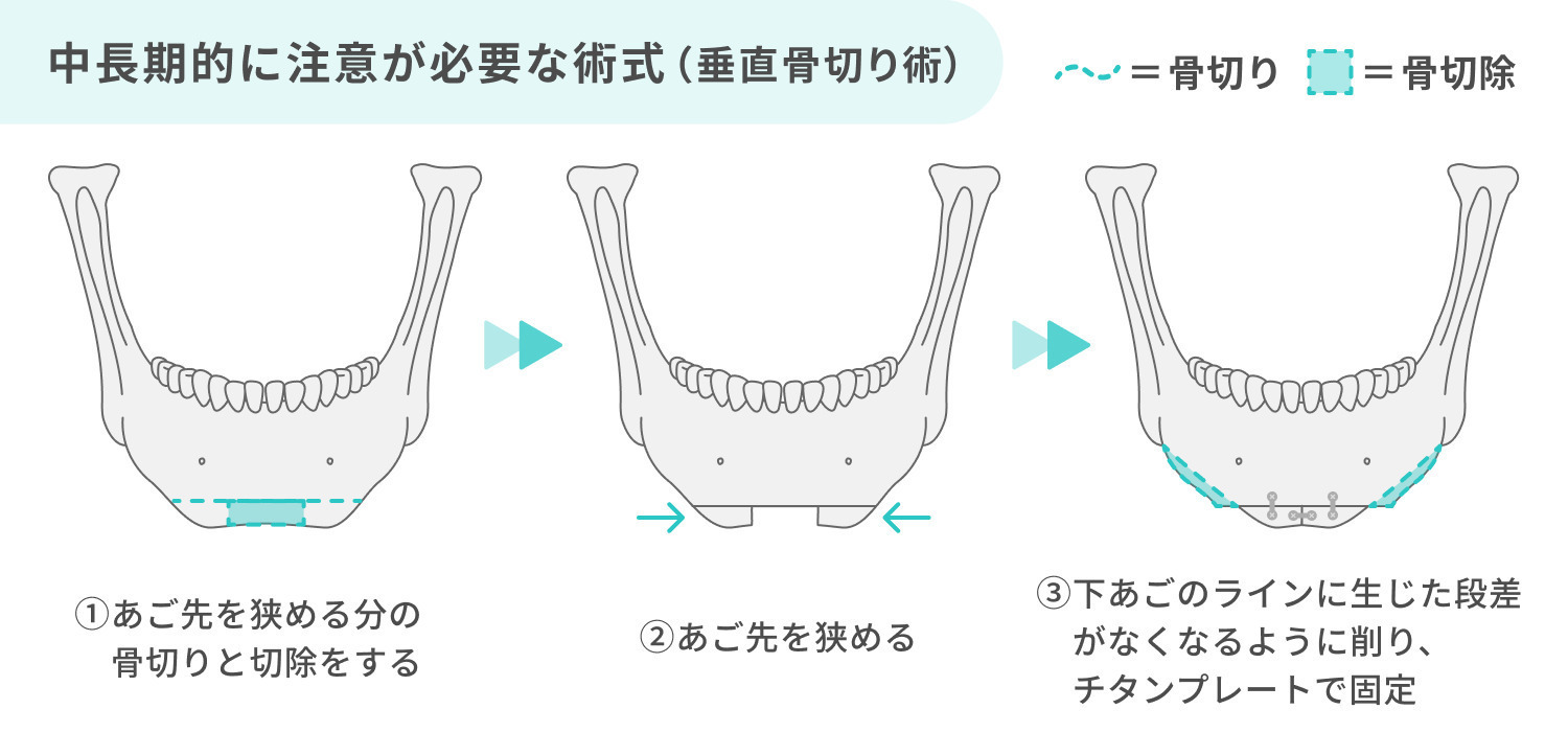 https://p1-1f54eb9e.imageflux.jp/uploads/image/file/6896/7b6970c3-5196-4a51-9842-0b9b147cd2b0.jpg