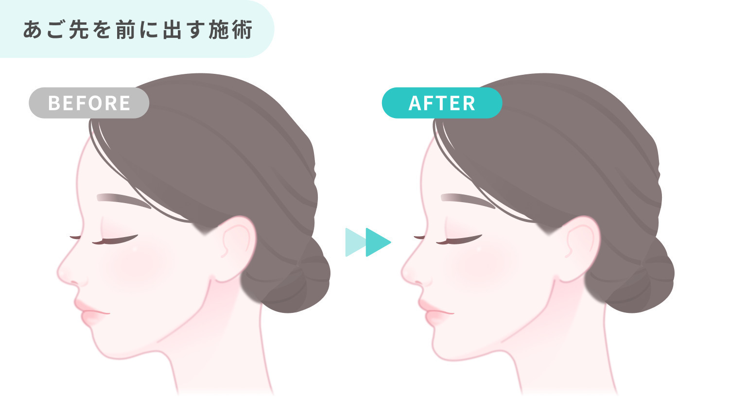 https://p1-1f54eb9e.imageflux.jp/uploads/image/file/6897/bd471987-d783-4430-baf5-e879e63d35c2.jpg