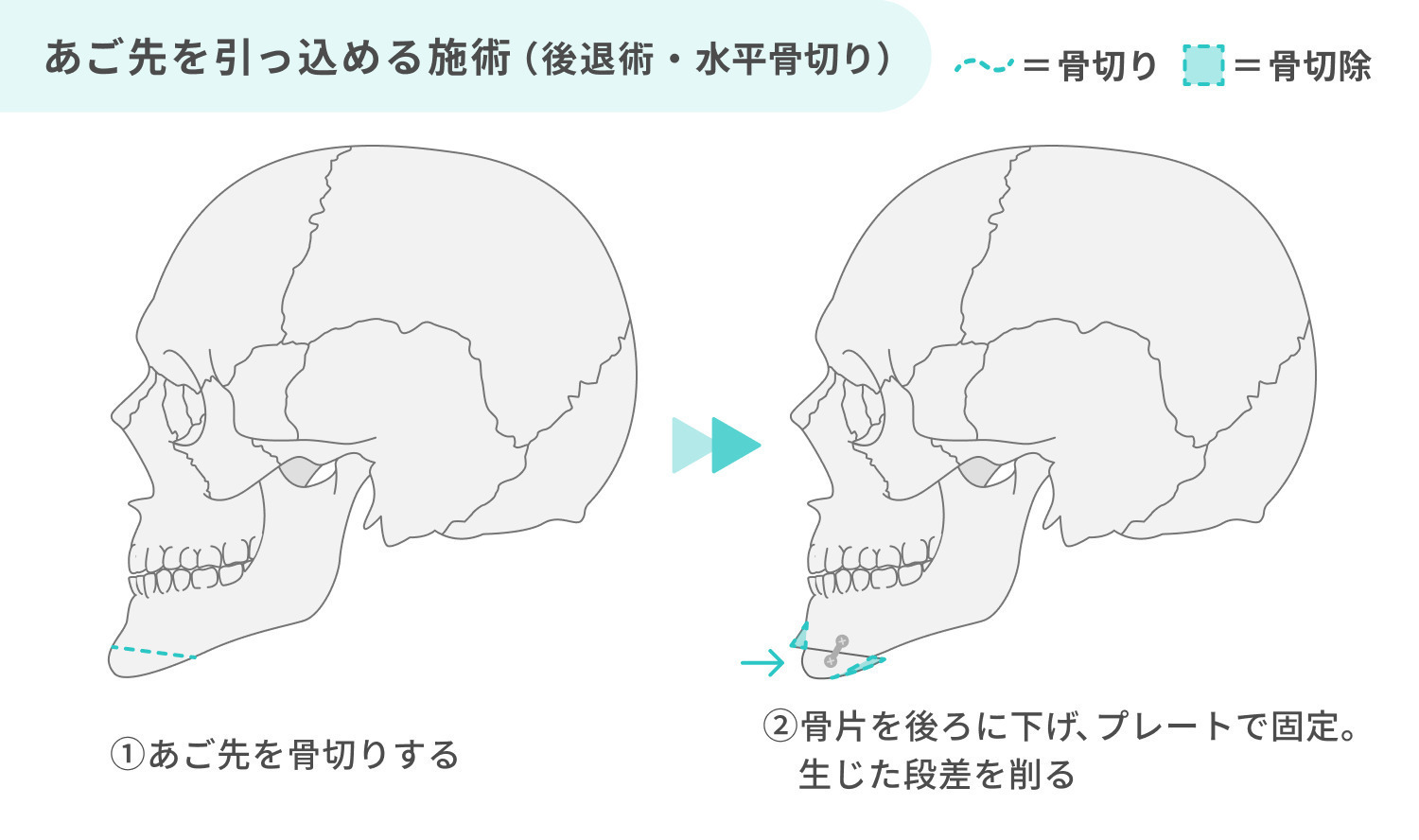 https://p1-1f54eb9e.imageflux.jp/uploads/image/file/6900/c7fc5cf7-3c47-4132-a5e1-30acfcf740f1.jpg