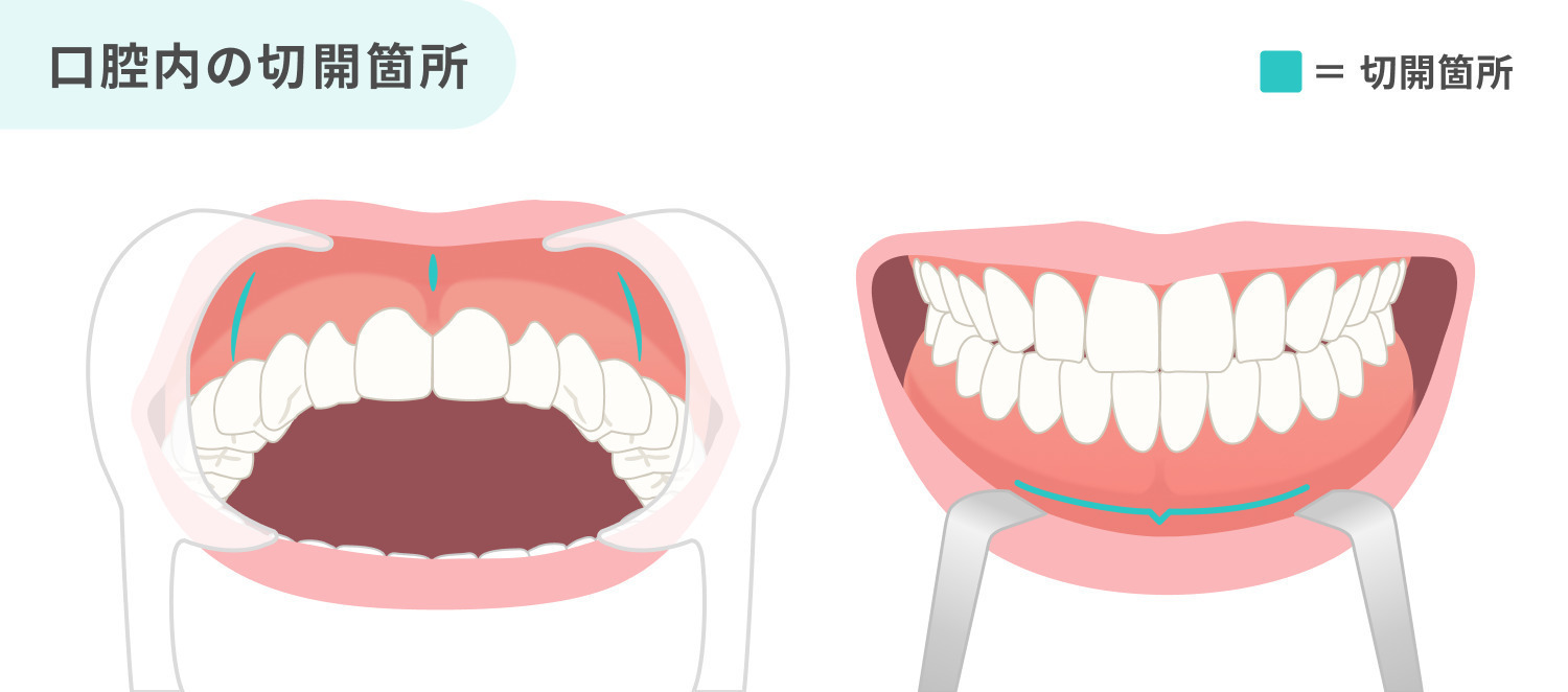 https://p1-1f54eb9e.imageflux.jp/uploads/image/file/7033/c61dbf37-aaab-416d-aa10-2daef808cf9b.jpg