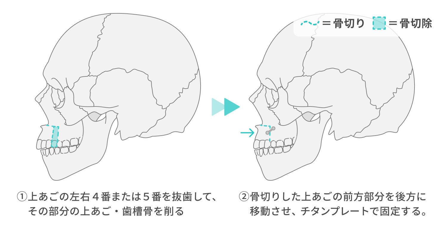 https://p1-1f54eb9e.imageflux.jp/uploads/image/file/7035/0aa2e5e4-b7e9-47b3-8134-8526e68d0e09.jpg