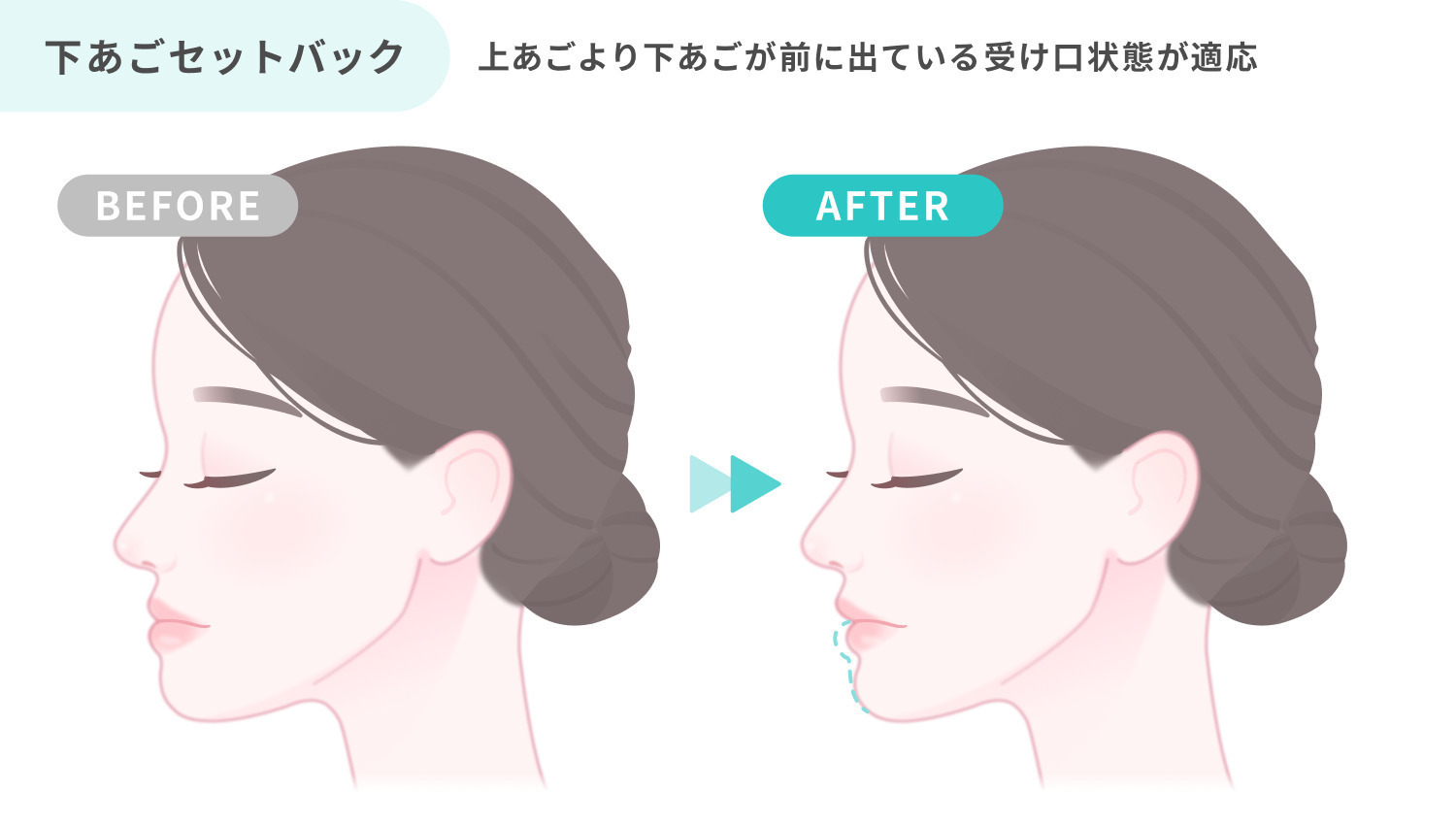https://p1-1f54eb9e.imageflux.jp/uploads/image/file/7036/1945d93e-8f77-4a73-86c9-d9e304dc8a06.jpg