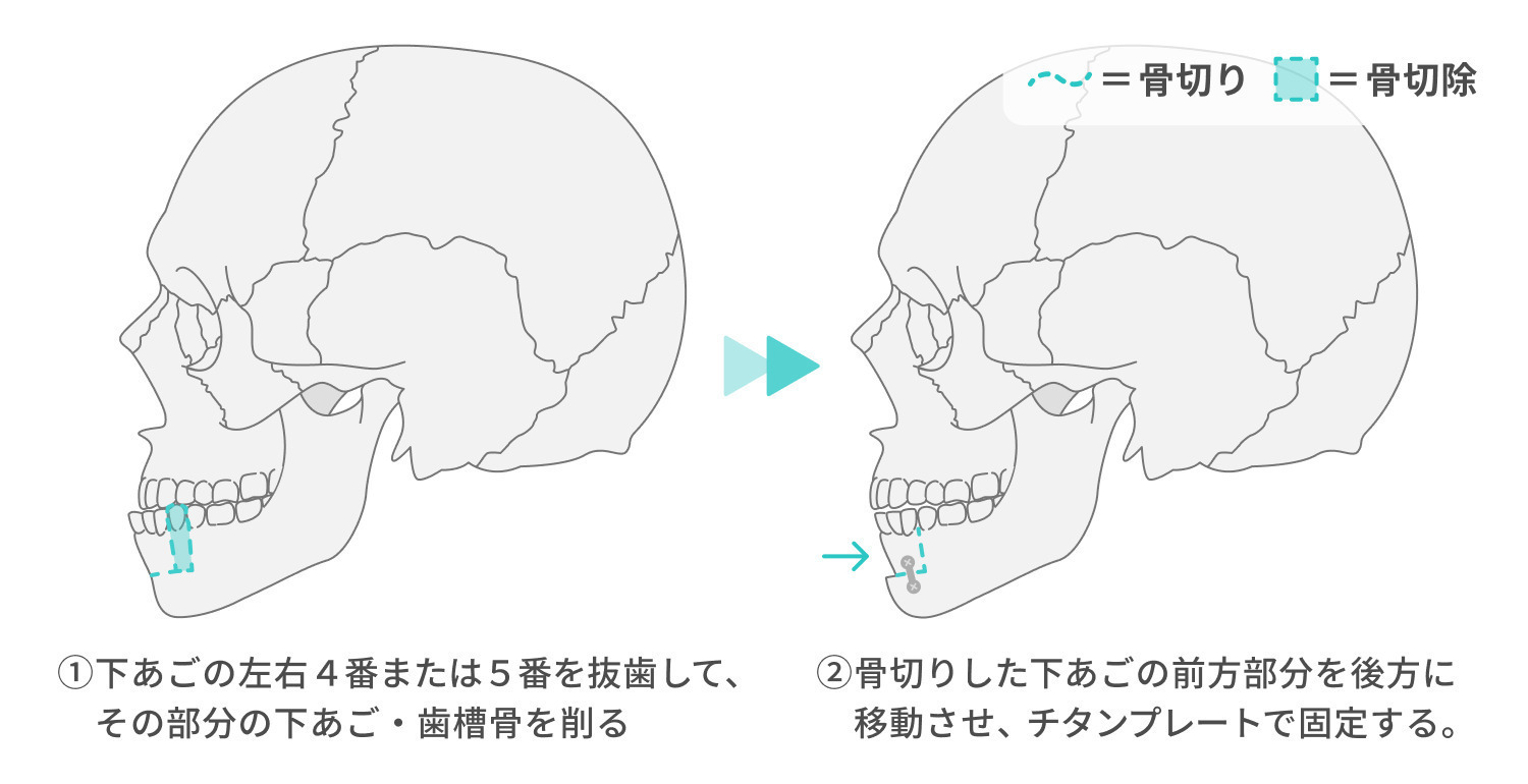 https://p1-1f54eb9e.imageflux.jp/uploads/image/file/7037/24770217-b054-4aee-8eb7-b932c4b549af.jpg