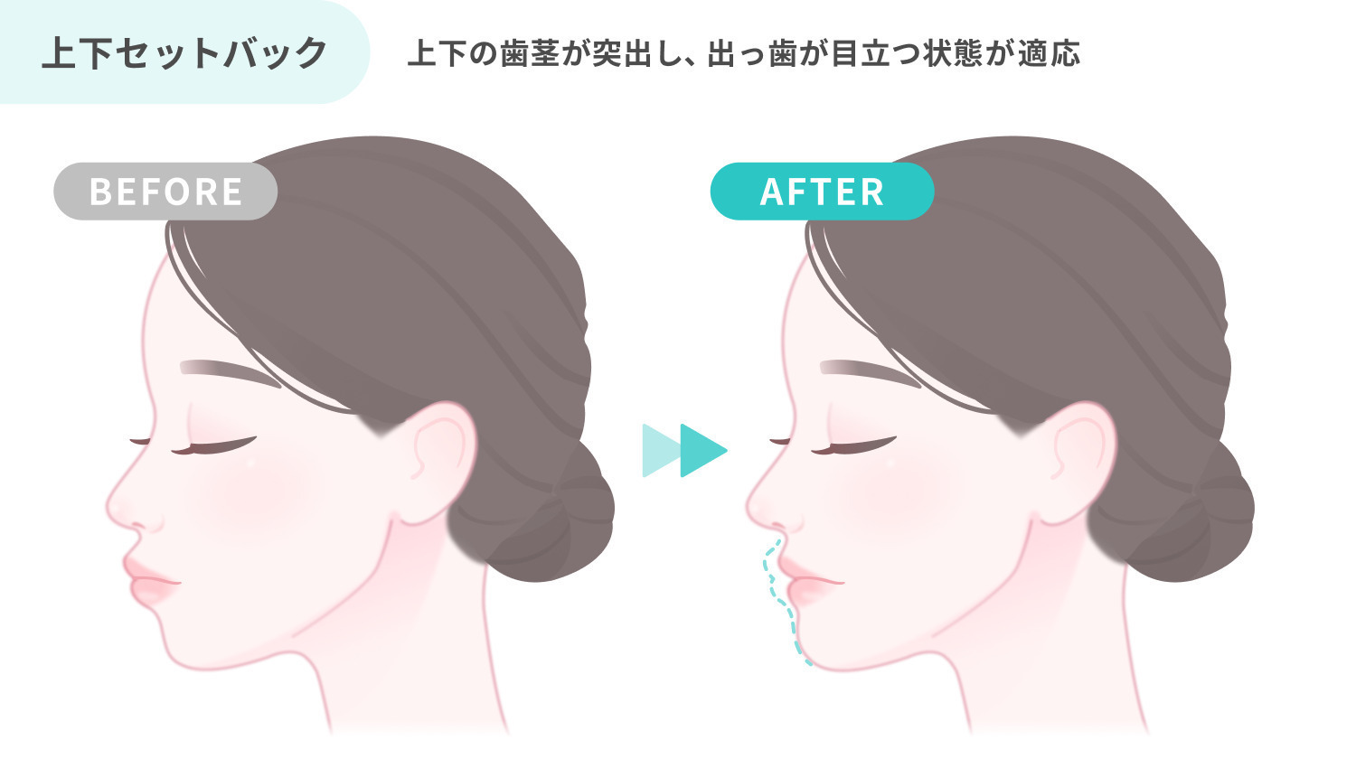 https://p1-1f54eb9e.imageflux.jp/uploads/image/file/7038/a9d391ed-4020-4e81-bb92-3972c15b3579.jpg