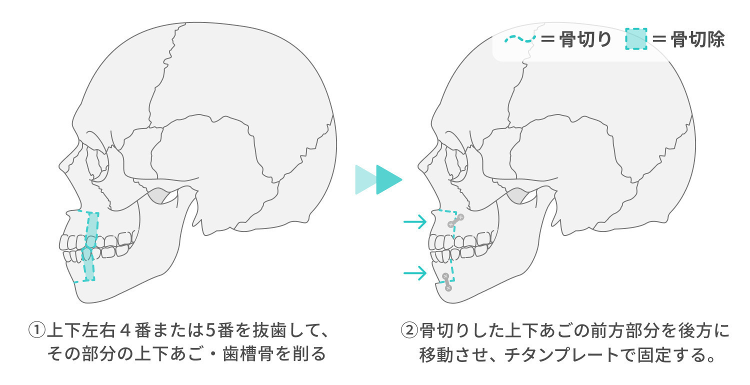 https://p1-1f54eb9e.imageflux.jp/uploads/image/file/7039/69f4fe67-58f5-46be-92be-a61bb936439e.jpg