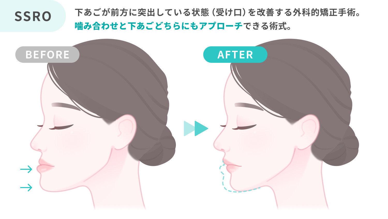 https://p1-1f54eb9e.imageflux.jp/uploads/image/file/7323/f5a231c8-a8ea-4166-8a5b-c332da3c052f.jpg