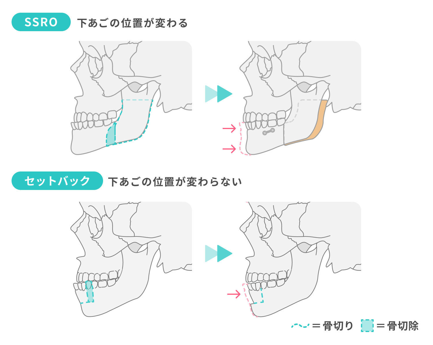 https://p1-1f54eb9e.imageflux.jp/uploads/image/file/7326/0456bdeb-6d69-4f78-87d0-5dc4e1a575f6.jpg