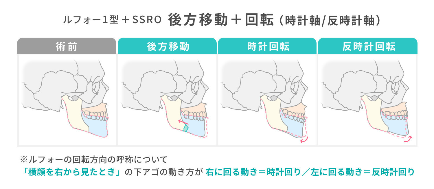 https://p1-1f54eb9e.imageflux.jp/uploads/image/file/7332/00174933-0eed-48eb-99eb-845b4f4f6879.jpg