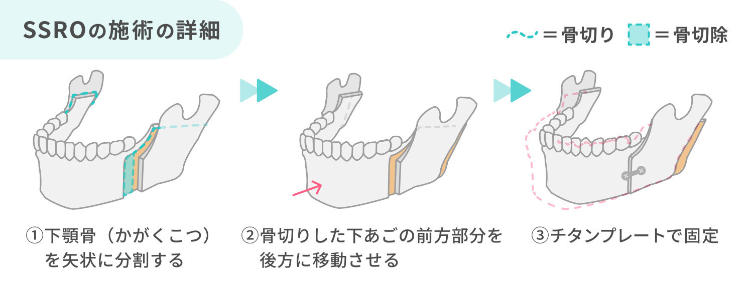 https://p1-1f54eb9e.imageflux.jp/uploads/image/file/7333/9859b5de-7cfb-409b-961b-213c4975027e.jpg