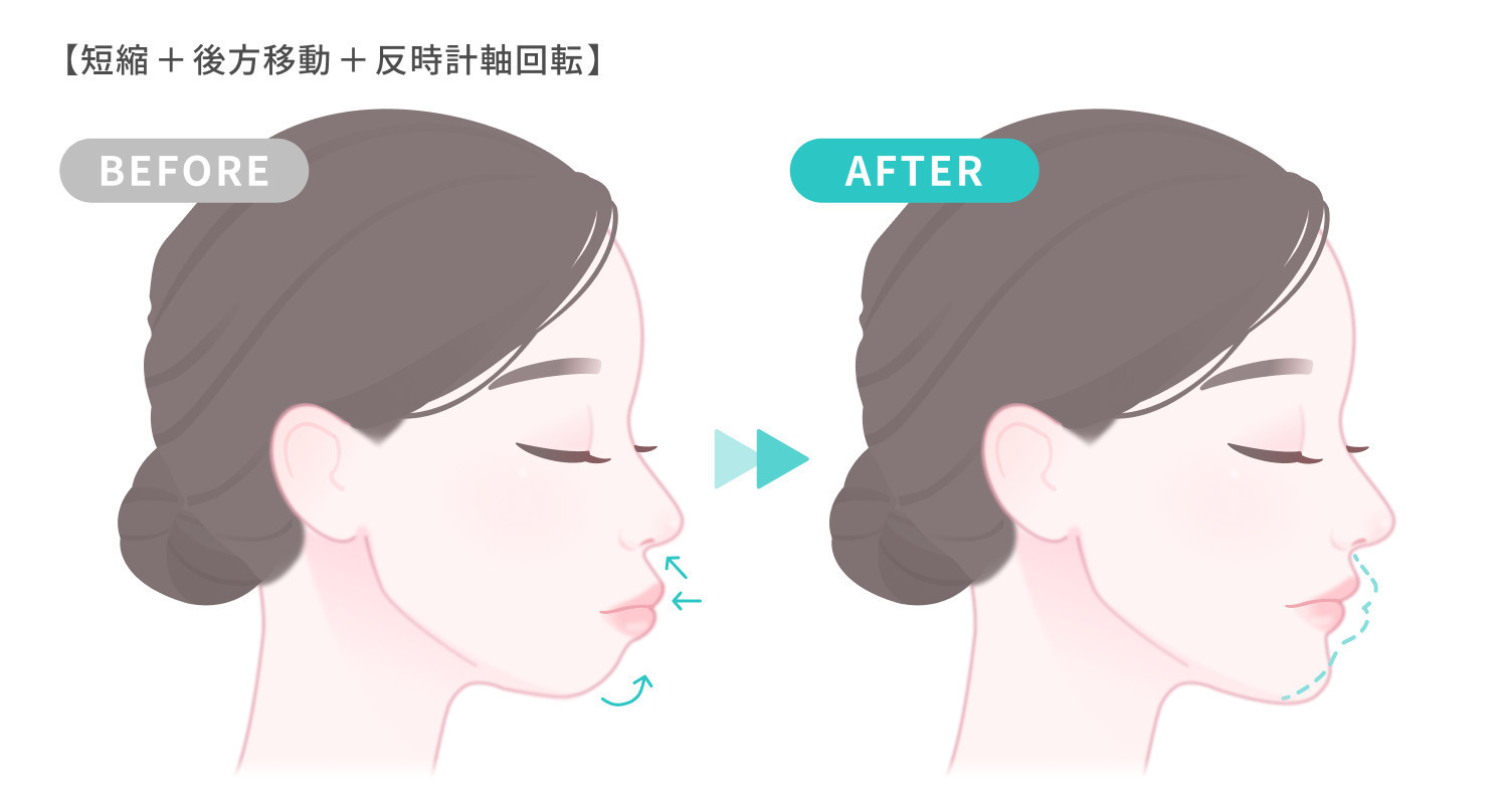 https://p1-1f54eb9e.imageflux.jp/uploads/image/file/7352/53c8df61-a000-40ec-9bfc-b5d7a836fe8c.jpg