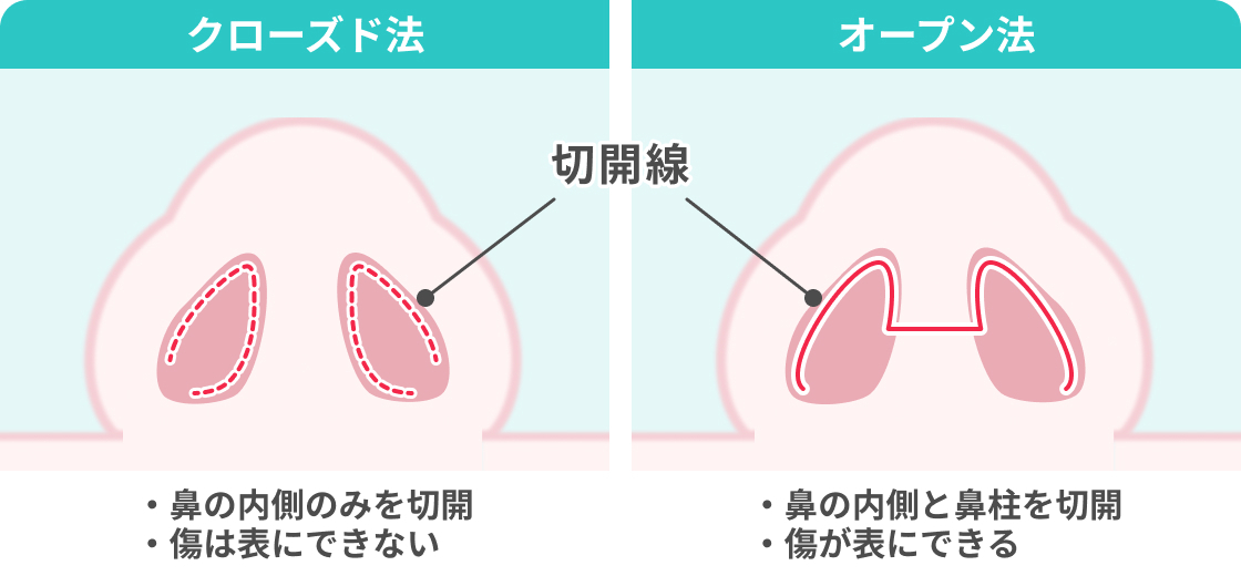 https://p1-1f54eb9e.imageflux.jp/uploads/image/file/7367/aabacf3b-e275-4f01-a4e1-62eabf2f157d.jpg