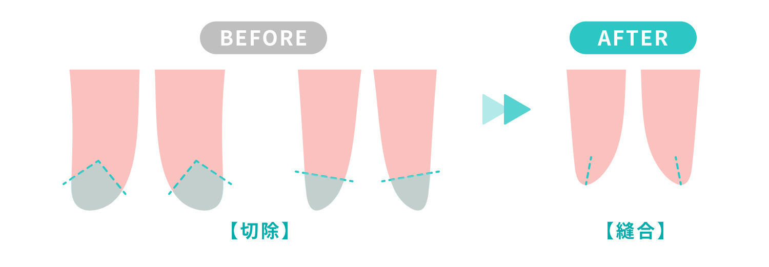 https://p1-1f54eb9e.imageflux.jp/uploads/image/file/7602/b62c6570-91be-481e-91c6-003666bc65f4.jpg