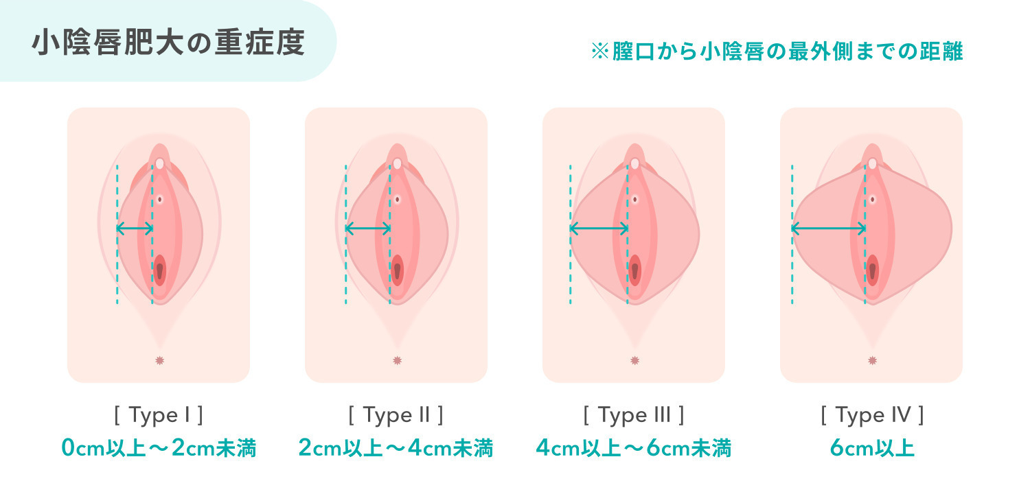 https://p1-1f54eb9e.imageflux.jp/uploads/image/file/7603/c3e598fc-3742-4f89-a809-ba2bd42e6871.jpg