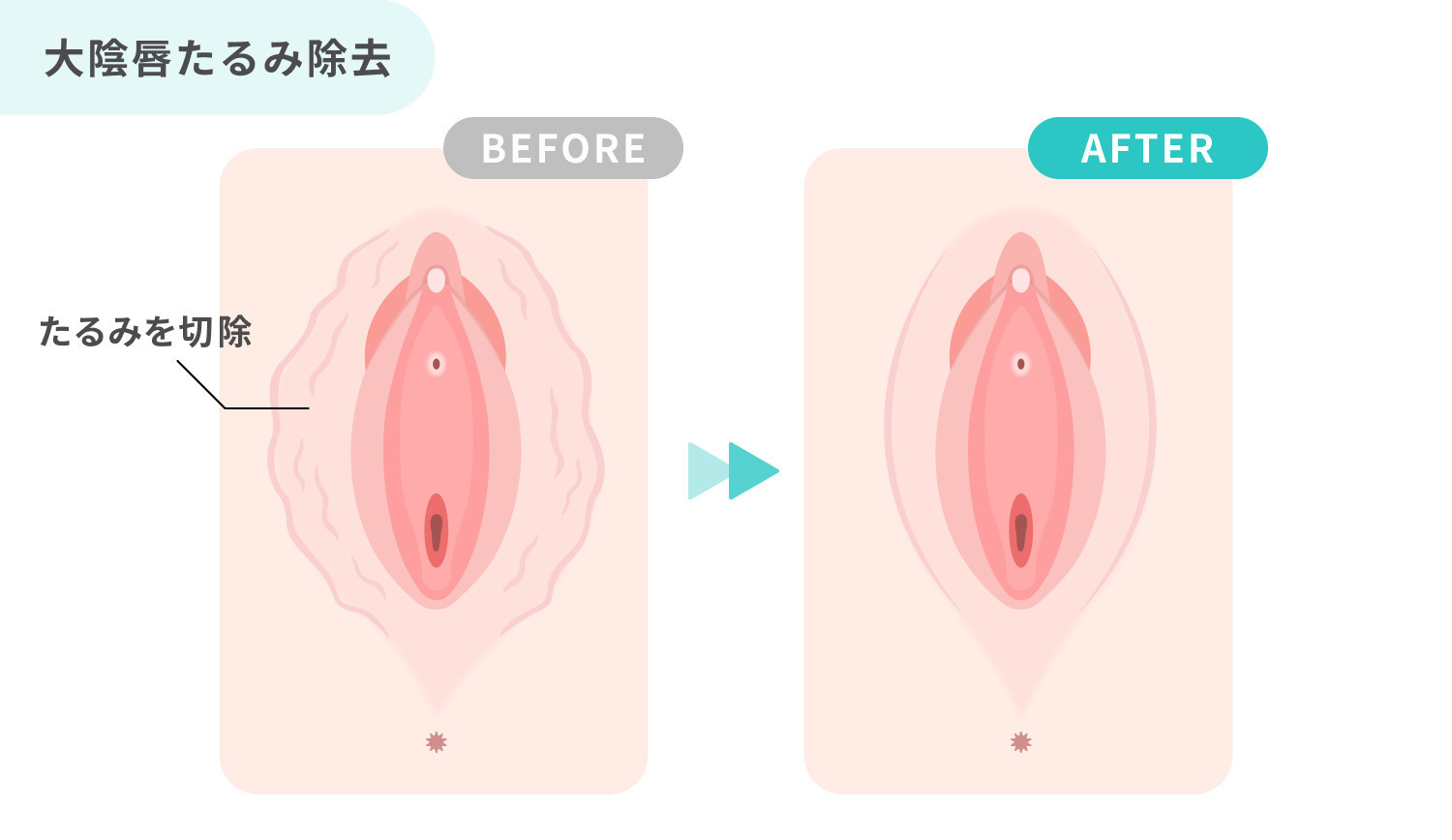 https://p1-1f54eb9e.imageflux.jp/uploads/image/file/7630/6efbecdd-8051-479c-946f-d94e7e16747d.jpg