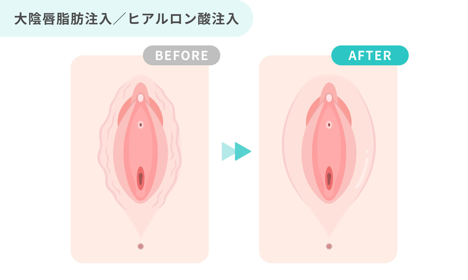 https://p1-1f54eb9e.imageflux.jp/uploads/image/file/7631/7ded8ec7-d40b-4264-98e1-fd1fc6a4724c.jpg