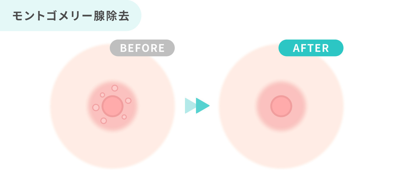 https://p1-1f54eb9e.imageflux.jp/uploads/image/file/7696/a77f7458-f192-45bd-8eba-249eac4d3f2d.jpg