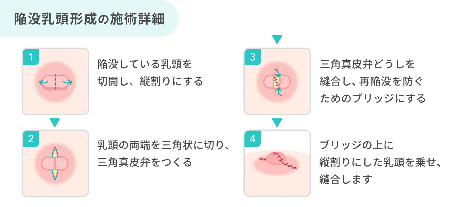 https://p1-1f54eb9e.imageflux.jp/uploads/image/file/7702/8bb7bdfb-b6d4-4138-a78b-e6dc86f9031f.jpg