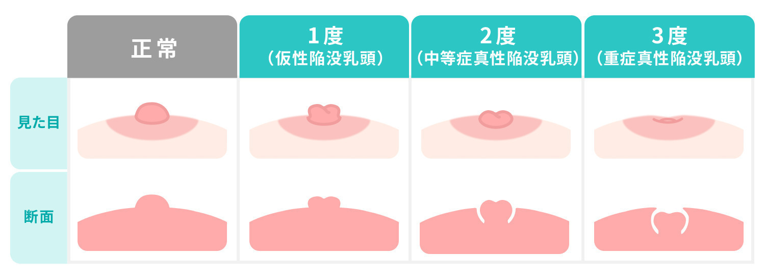 https://p1-1f54eb9e.imageflux.jp/uploads/image/file/7703/61de1307-f2f2-467e-b0d0-2783918a0a1f.jpg