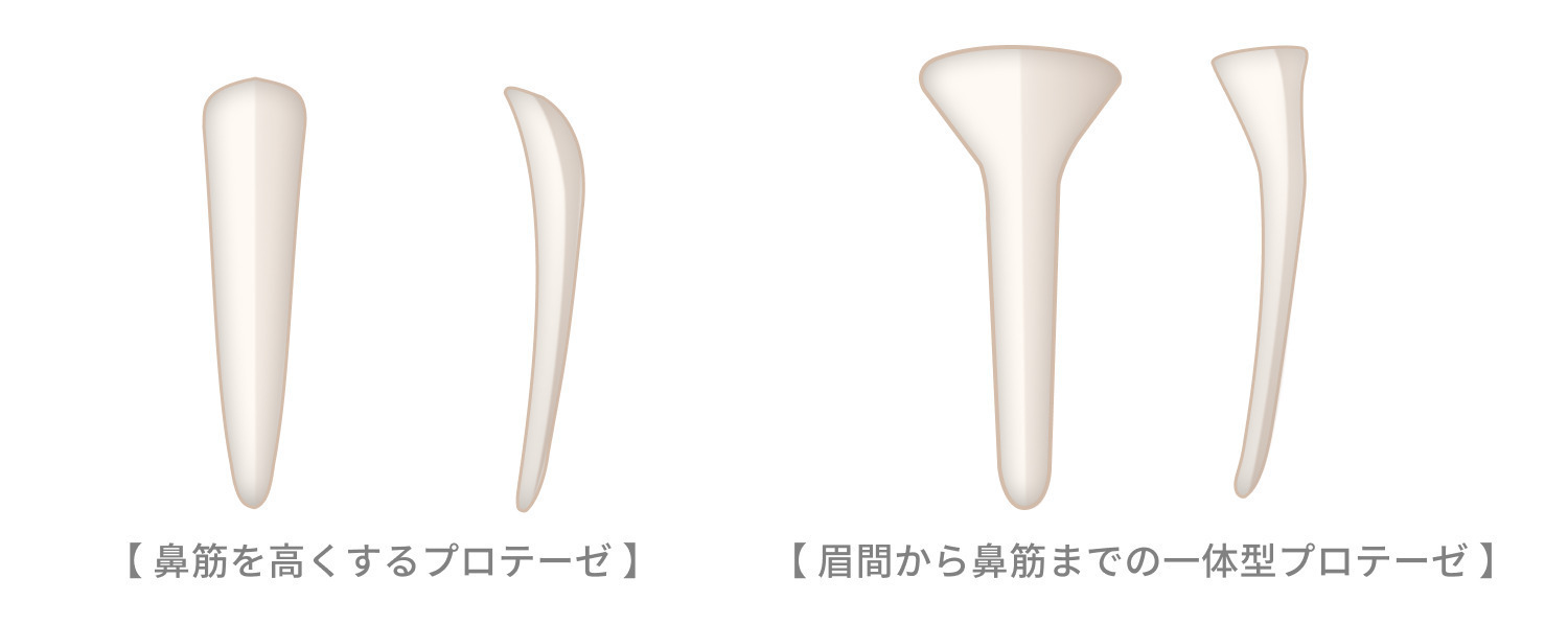 https://p1-1f54eb9e.imageflux.jp/uploads/image/file/7789/decfc2df-dce5-437b-b0c9-349e7839f45c.jpg