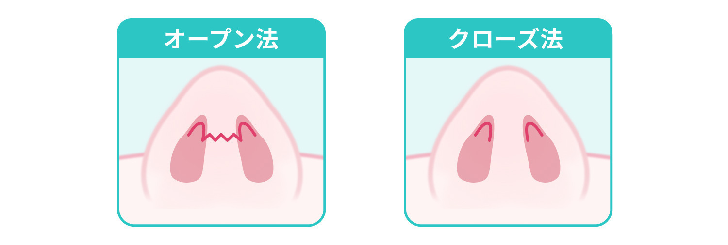 https://p1-1f54eb9e.imageflux.jp/uploads/image/file/7790/921b467c-564a-43a3-9ca5-3f7bf6d948a5.jpg