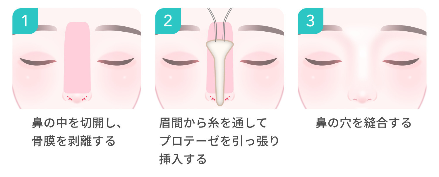 https://p1-1f54eb9e.imageflux.jp/uploads/image/file/7793/a5e690cd-d897-4d9c-afc5-563b86cdc832.jpg