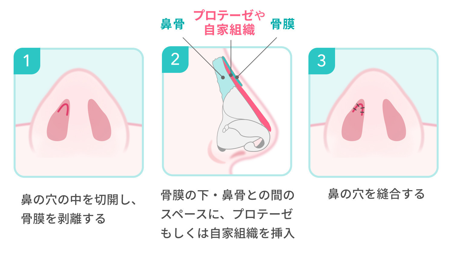https://p1-1f54eb9e.imageflux.jp/uploads/image/file/7804/74a2e07e-5984-4985-b646-f18ae09586ce.jpg