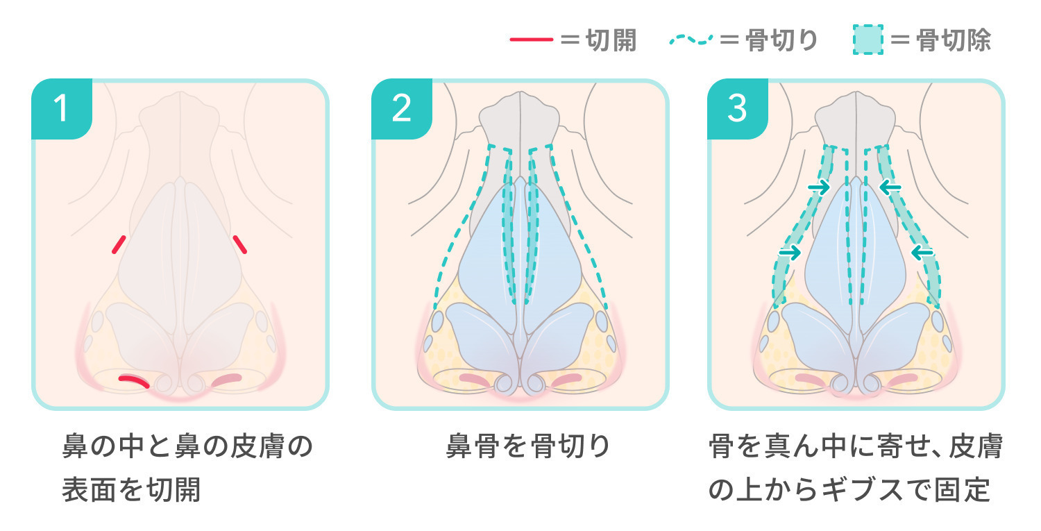 https://p1-1f54eb9e.imageflux.jp/uploads/image/file/7933/5002fd70-a25d-4959-b0c1-77c59a7f77f1.jpg