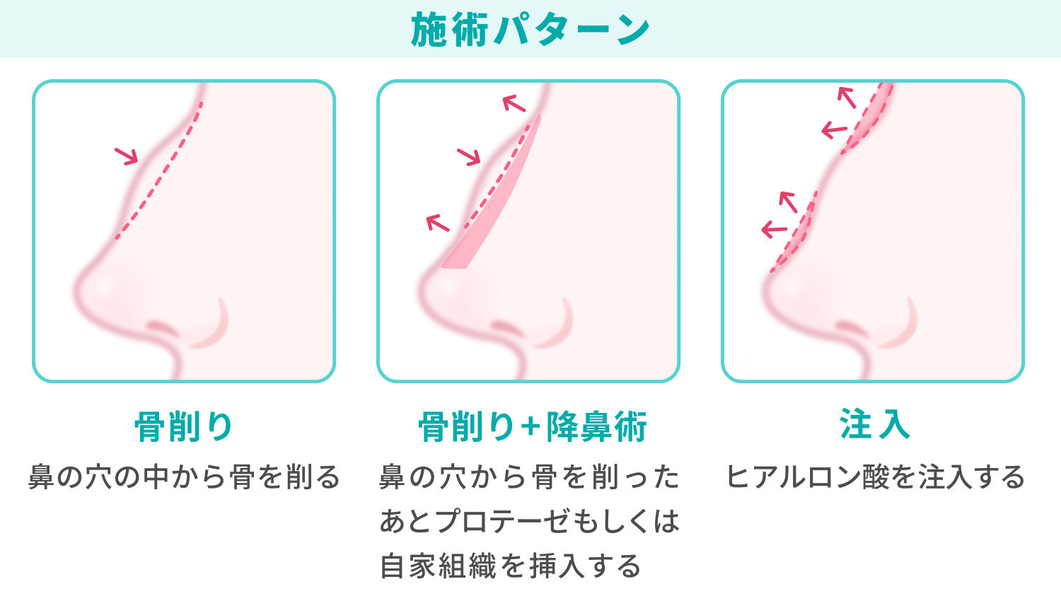 https://p1-1f54eb9e.imageflux.jp/uploads/image/file/7935/55ad827a-6b9e-4ab6-bb66-384c18d8bc5b.jpg