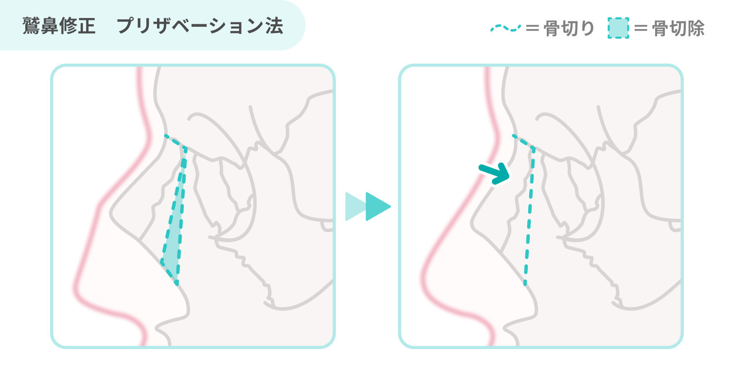 https://p1-1f54eb9e.imageflux.jp/uploads/image/file/7936/cdea60ad-f5fa-4f40-9248-6ced65b7755b.jpg