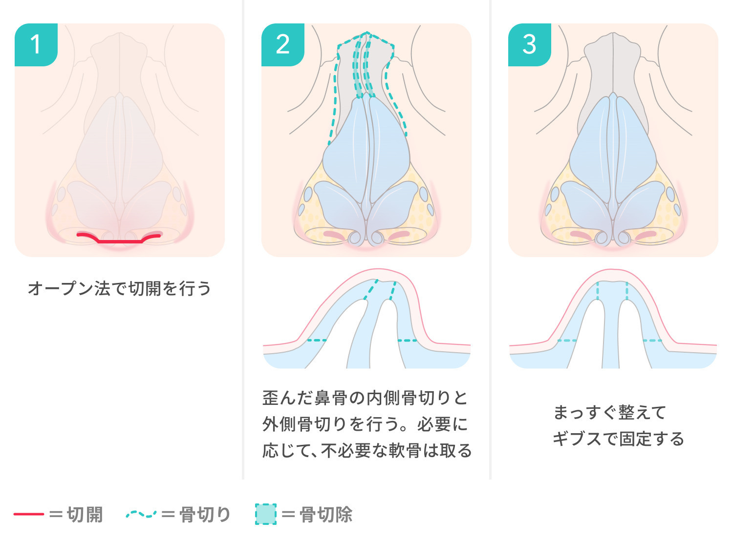 https://p1-1f54eb9e.imageflux.jp/uploads/image/file/7938/61ef8ce3-be4c-4528-83e0-014fe27208a8.jpg