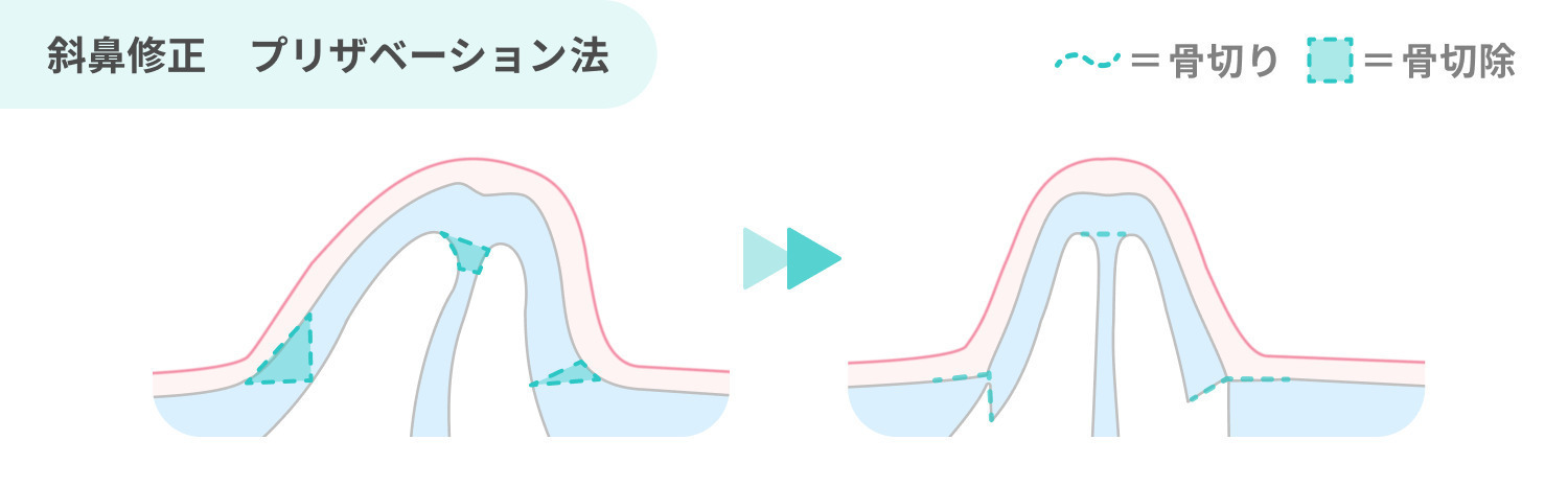 https://p1-1f54eb9e.imageflux.jp/uploads/image/file/7939/b29f0f3e-af5e-4593-b2b4-326f58d796ab.jpg