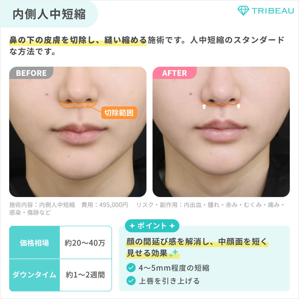 人中短縮 解説画像2 メイン用