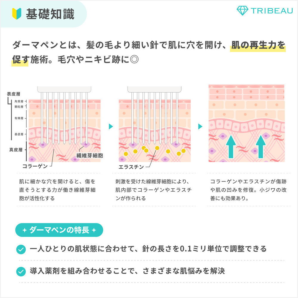 ダーマペン 解説画像1 メイン用