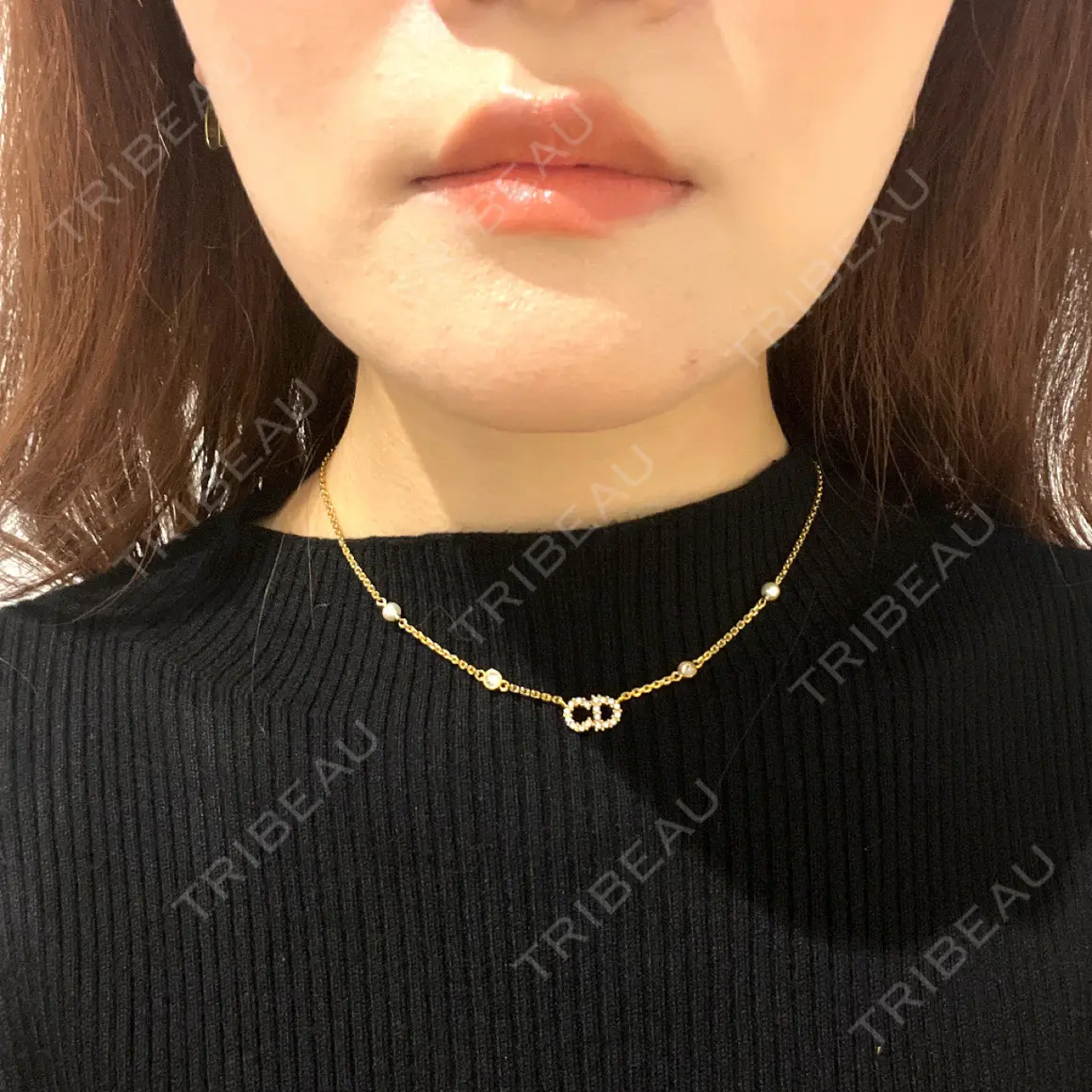 ボトックス（エラ・小顔） 9BeautyClinic DAY 0