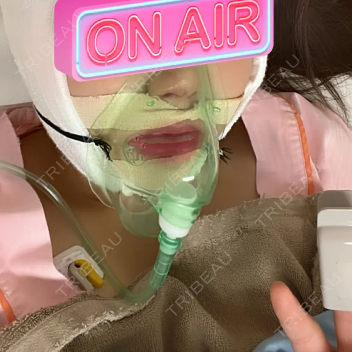 セットバック 大塚美容形成外科・歯科 大塚本院 DAY 0