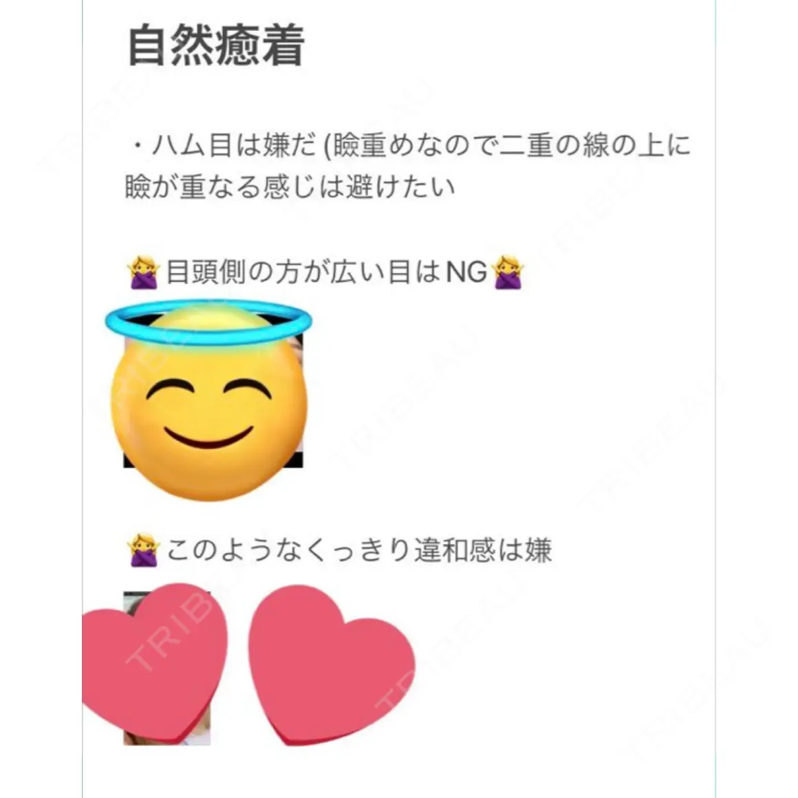 タレ目形成・グラマラスライン（切開） / 自然癒着法 プロミス整形外科 AFTER