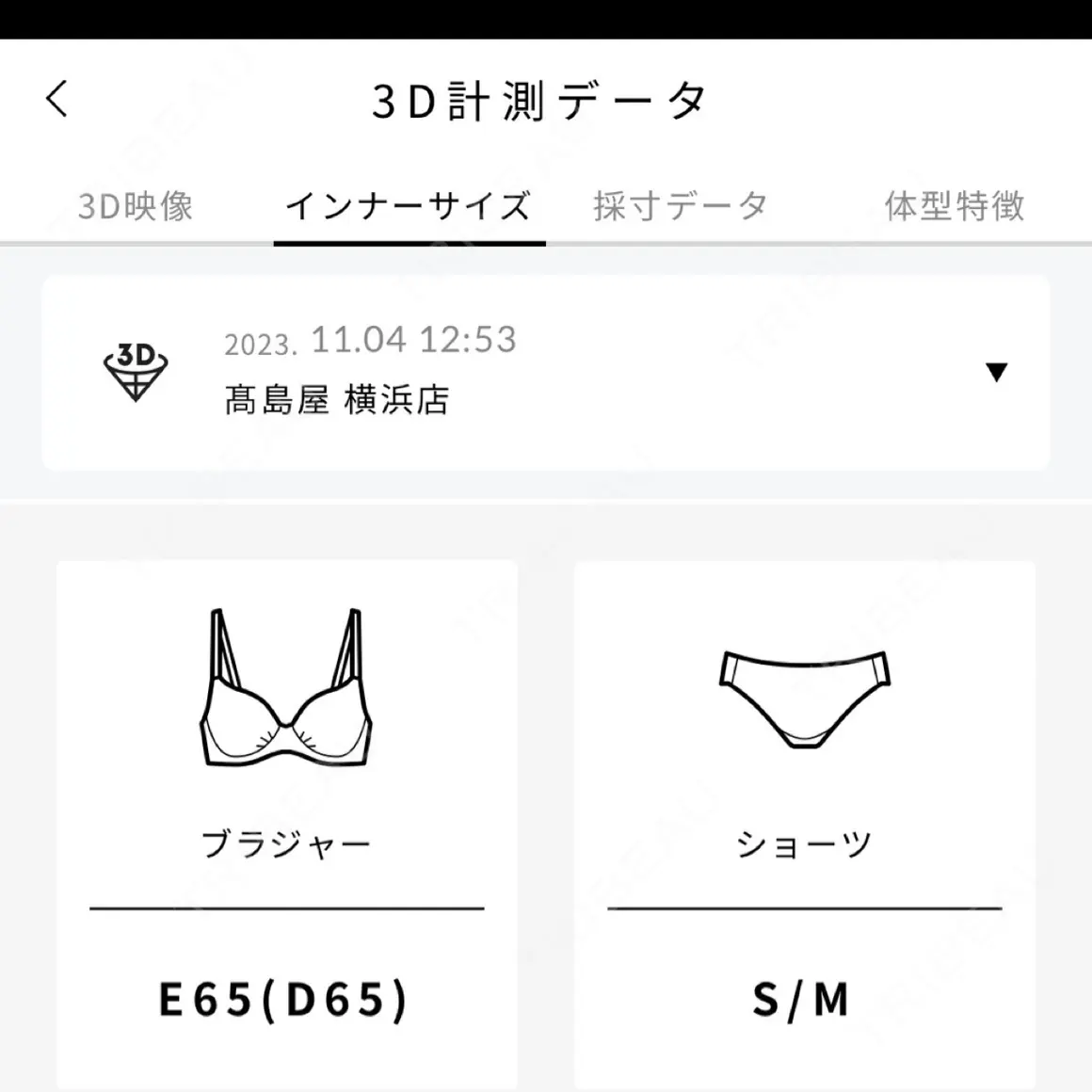 豊胸（脂肪注入） MYCLI【マイクリ】東京・恵比寿院 AFTER
