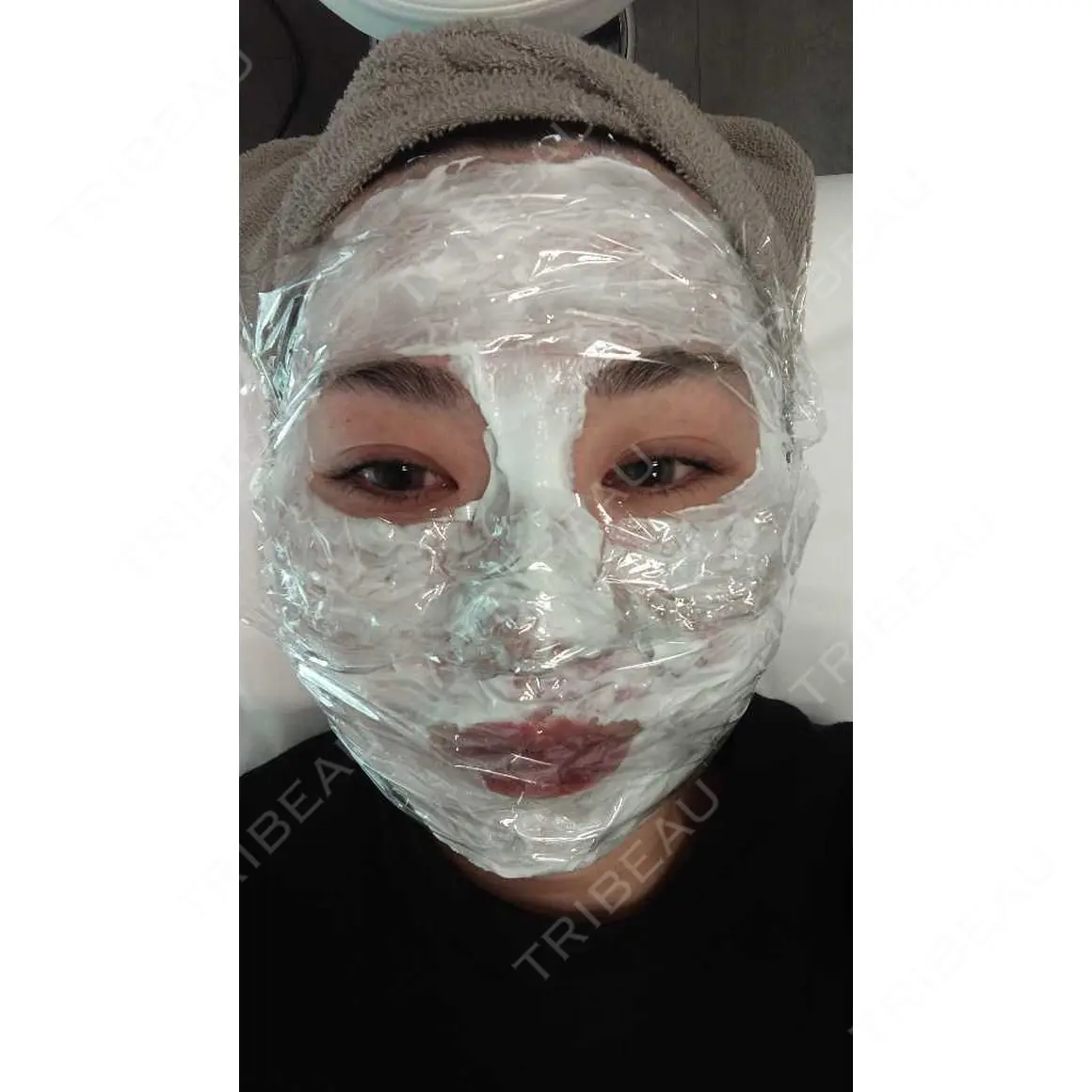 ポテンツァ 9BeautyClinic DAY 0